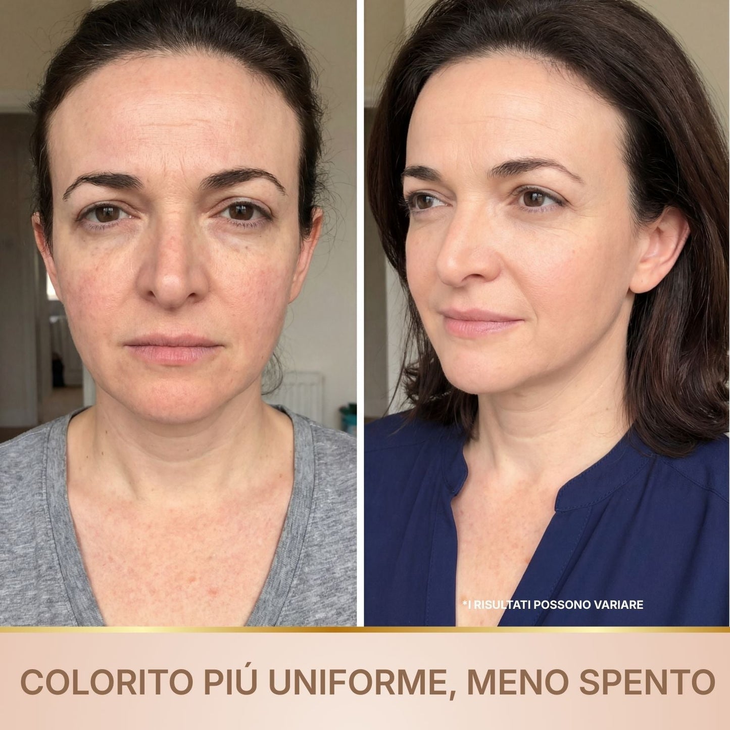Siero antirughe BioChroma prima e dopo colorito uniforme pelle luminosa meno spenta peptidi di seta
