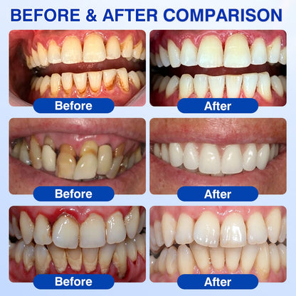 👨‍⚕️✅🦷Nestovie® GumRevive Periodontal Repair Gel