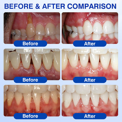 👨‍⚕️✅🦷Nestovie® GumRevive Periodontal Repair Gel