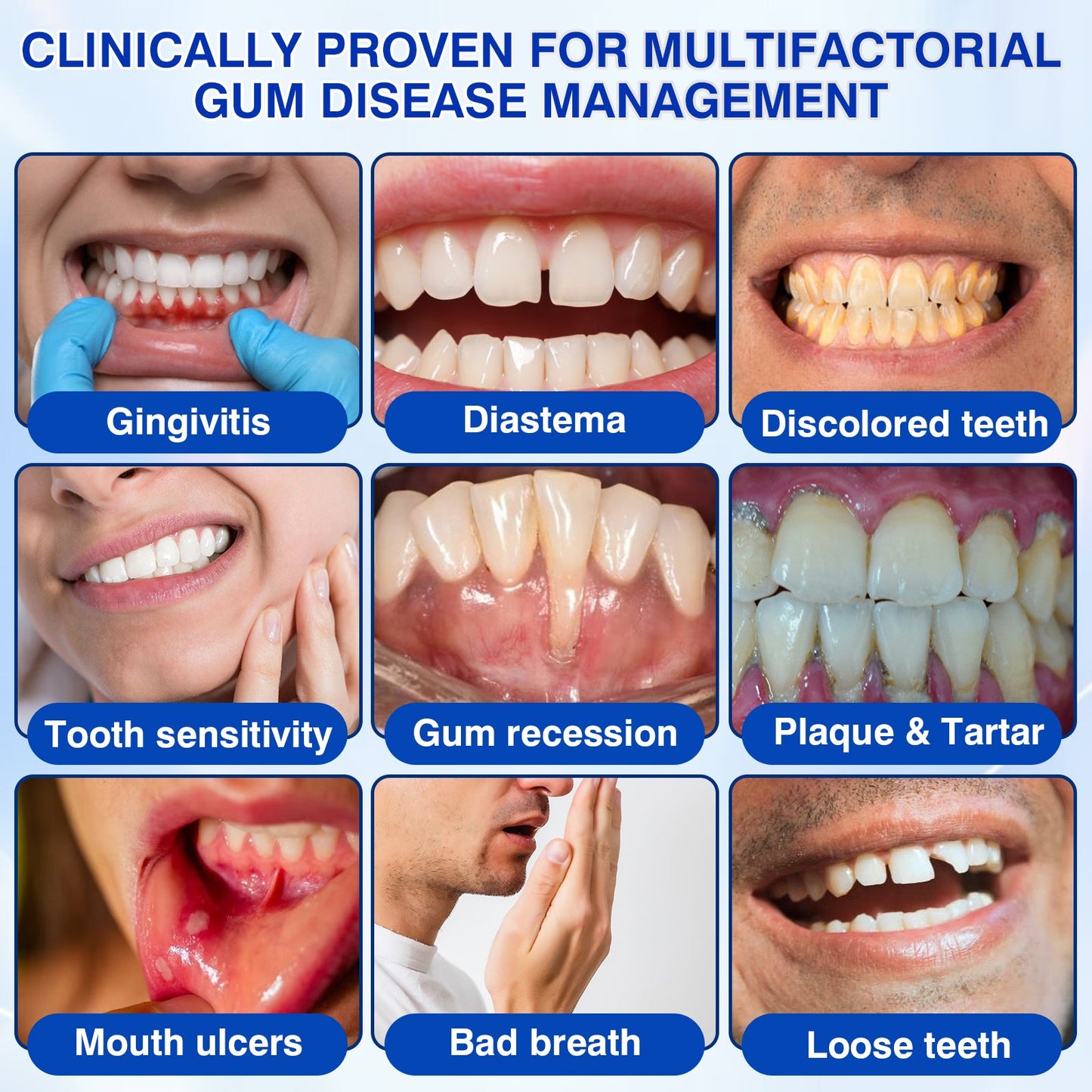 👨‍⚕️✅🦷Nestovie® GumRevive Periodontal Repair Gel