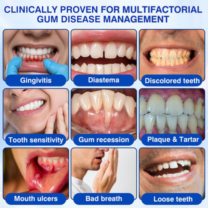 👨‍⚕️✅🦷Nestovie® GumRevive Periodontal Repair Gel