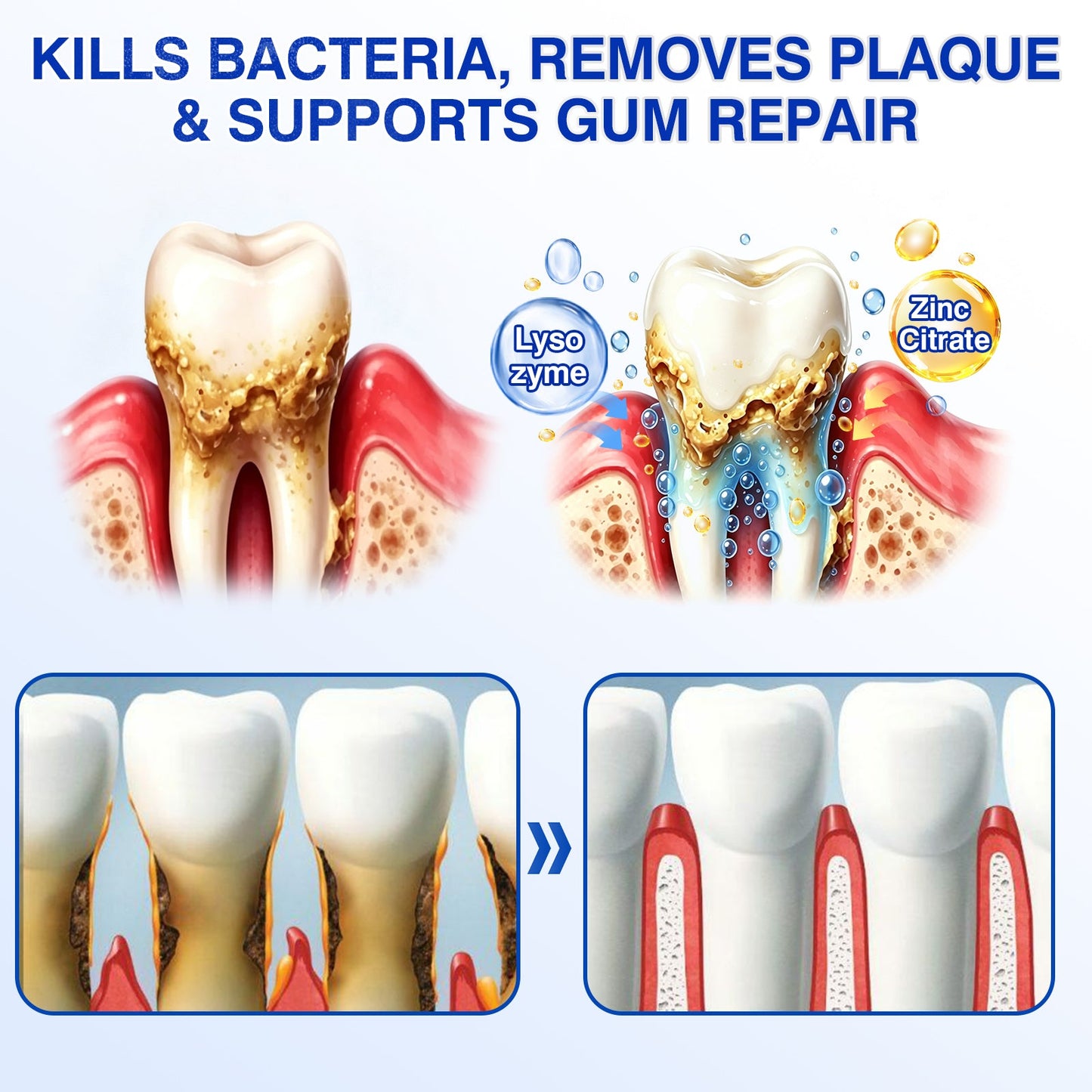 👨‍⚕️✅🦷Nestovie® GumRevive Periodontal Repair Gel