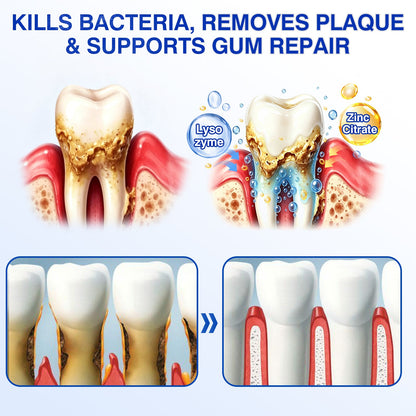 👨‍⚕️✅🦷Nestovie® GumRevive Periodontal Repair Gel