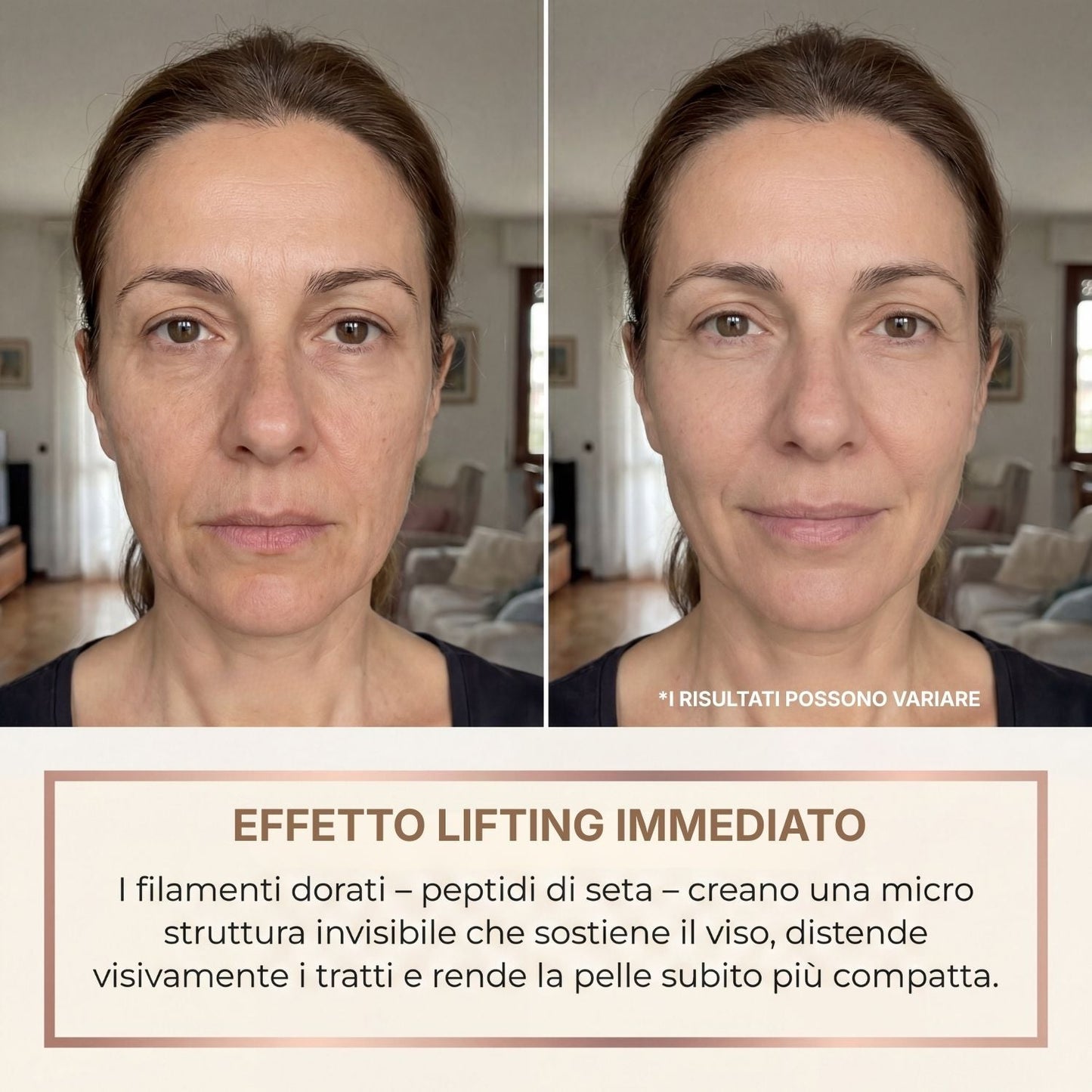 Siero antirughe prima e dopo effetto lifting immediato rughe espressione