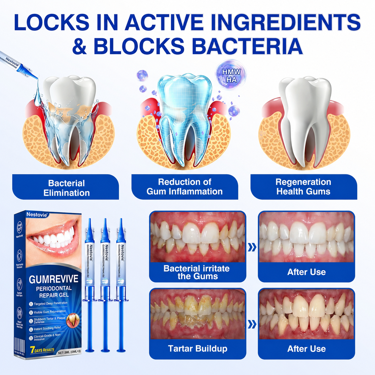 👨‍⚕️✅🦷Nestovie® GumRevive Periodontal Repair Gel