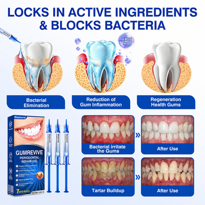 👨‍⚕️✅🦷Nestovie® GumRevive Periodontal Repair Gel