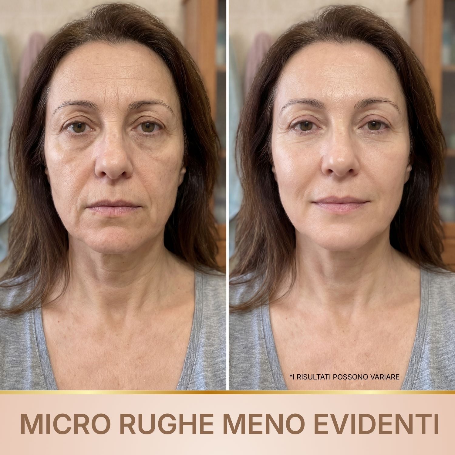 Siero antirughe BioChroma risultati rughe profonde e rughe di espressione meno evidenti