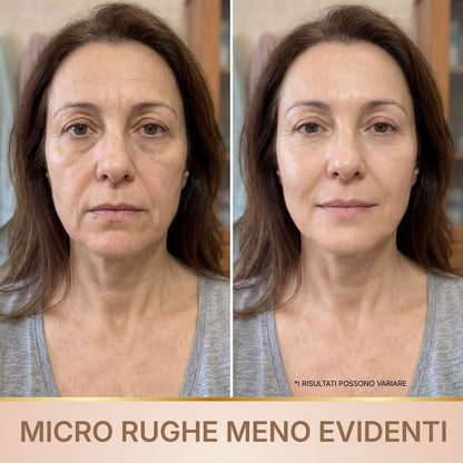 Siero antirughe BioChroma risultati rughe profonde e rughe di espressione meno evidenti