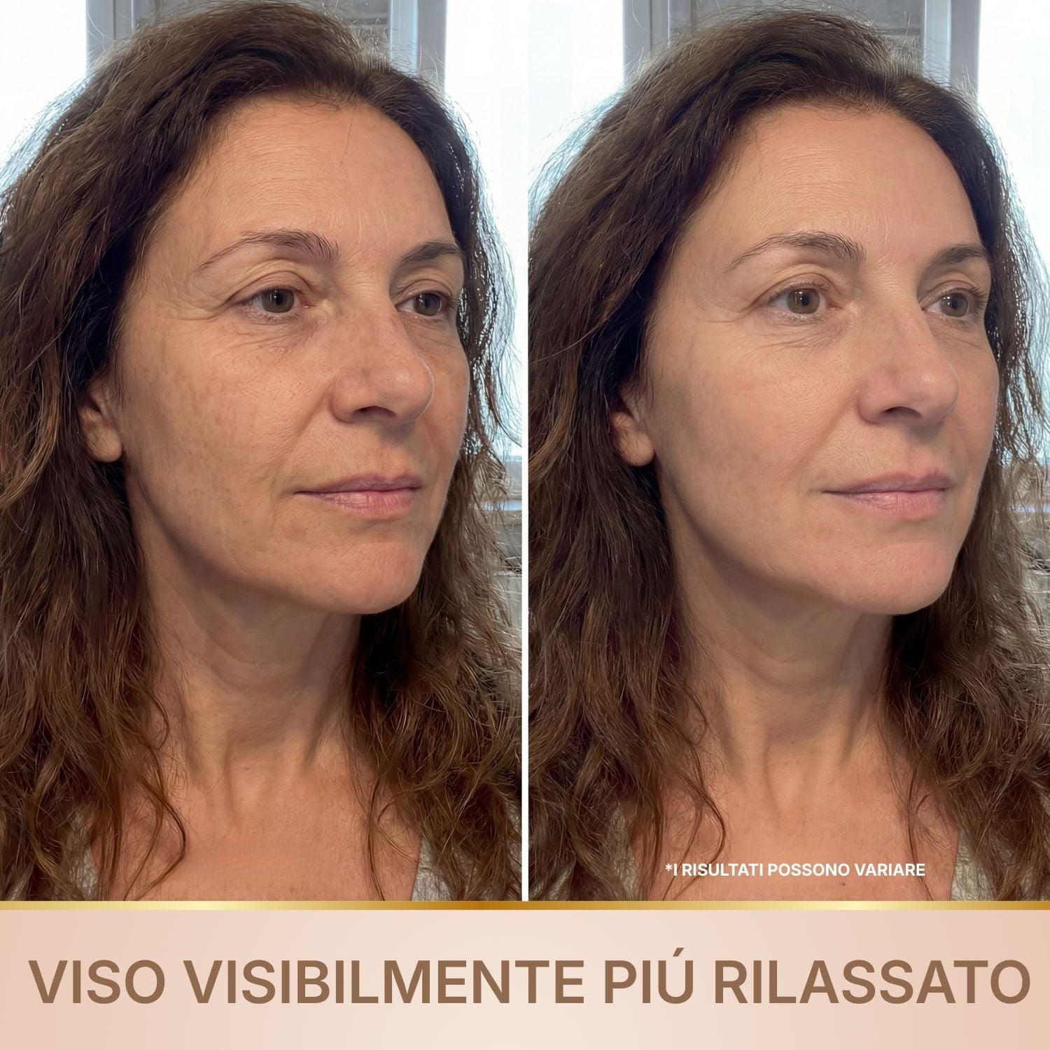 Siero antirughe BioChroma prima e dopo viso più rilassato rughe di espressione ridotte pelle compatta
